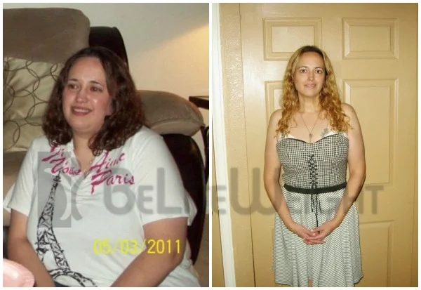 One Year Weight Loss Surgery Results Liz - One Year After Weight Loss Surgery